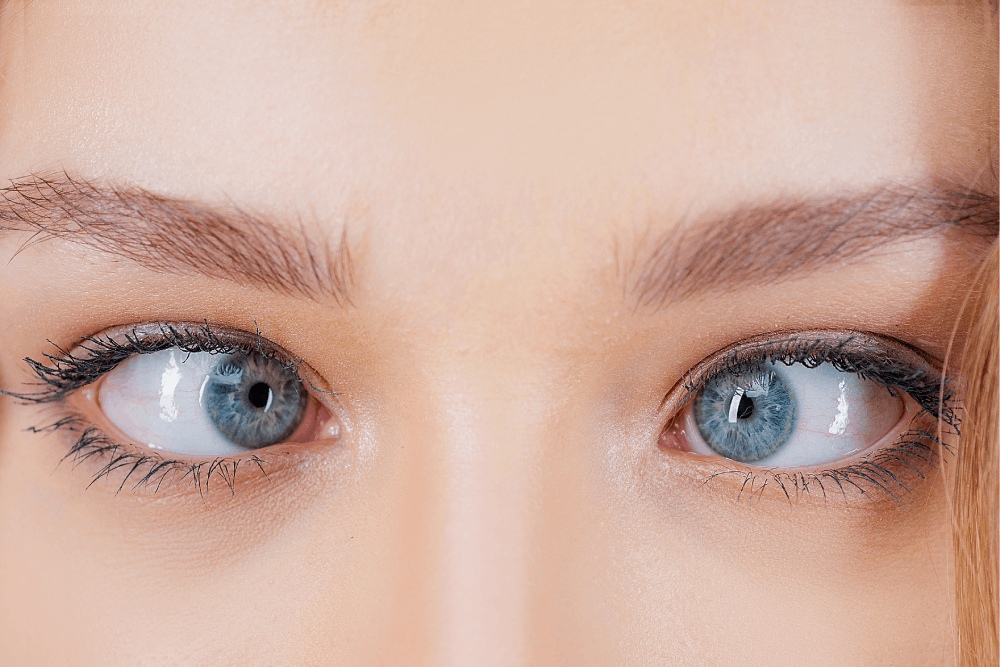 Squint Evaluation and Surgical Correction treatment in Dhule