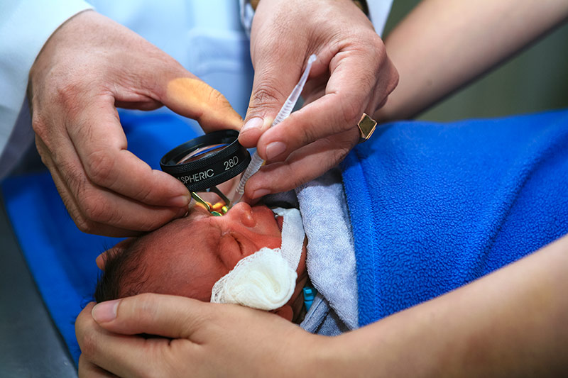 Retinopathy of Prematurity screening in Dhule